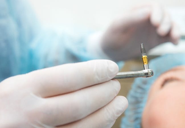 Dentist preparing to surgically place dental implant in patient’s jaw