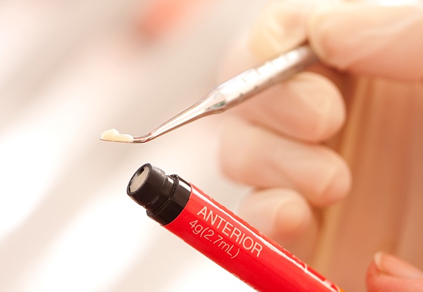 Dentist in Pittsburgh holding composite resin used in cosmetic dental bonding 