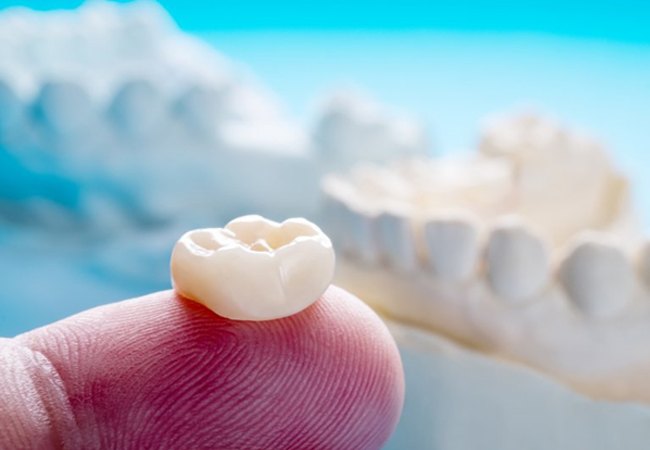 dentist in Pittsburgh holding a dental crown on their finger 