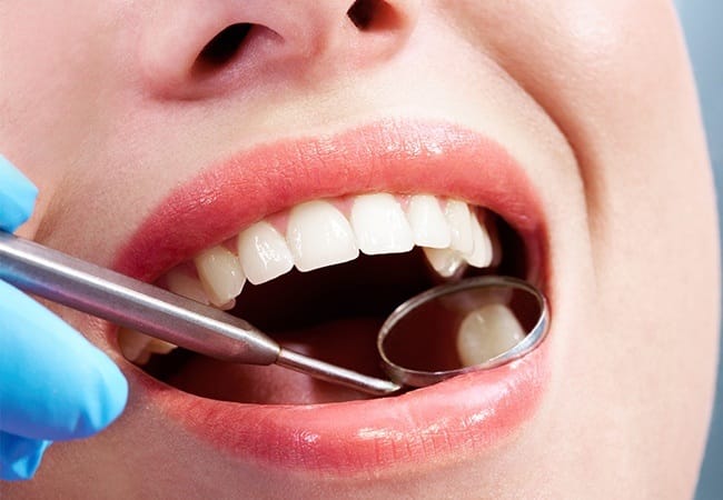 Dentist checking patient's tooth-colored filling at the end of a restorative dentistry appointment