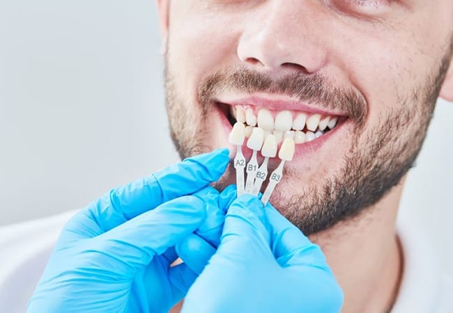 man being fitted for veneers 