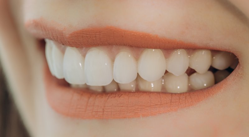 Porcelain veneers in Pittsburgh