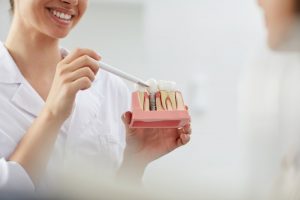 dentist showing a patient a model of how dental implant surgery works 