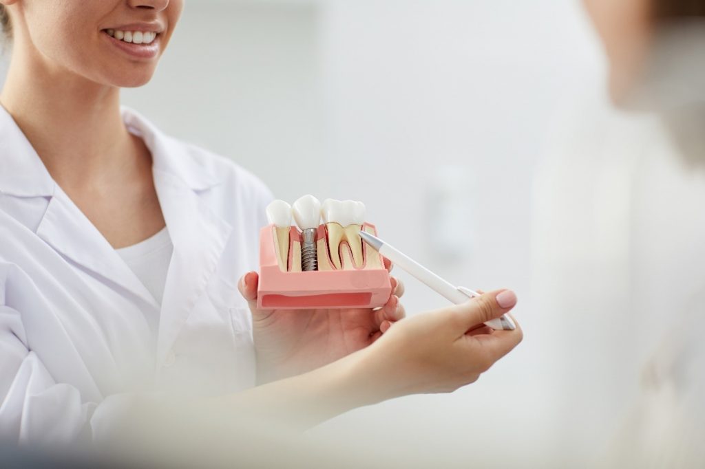 Dentist pointing to model of dental implant