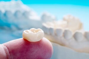 Person holding their dental crown